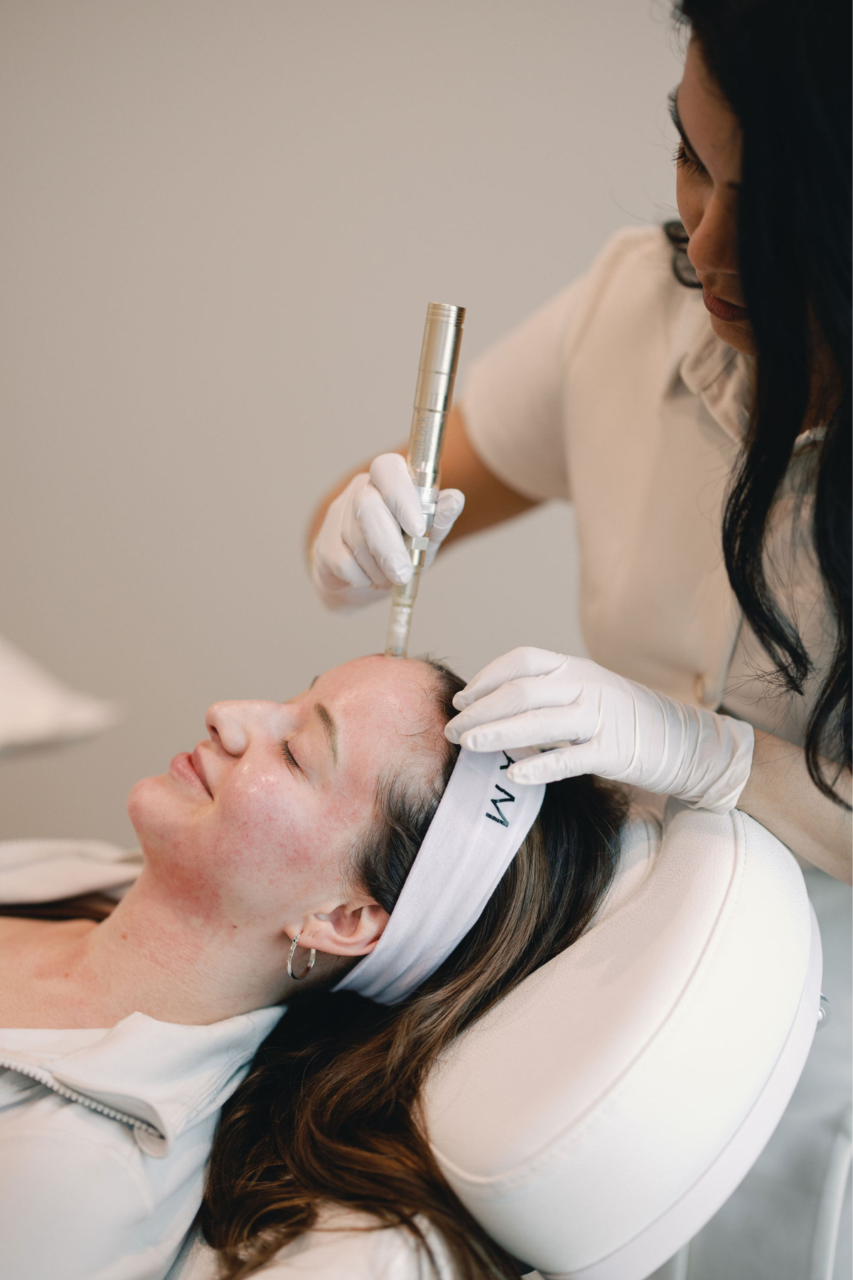 What to Expect During Your Microneedling Treatment