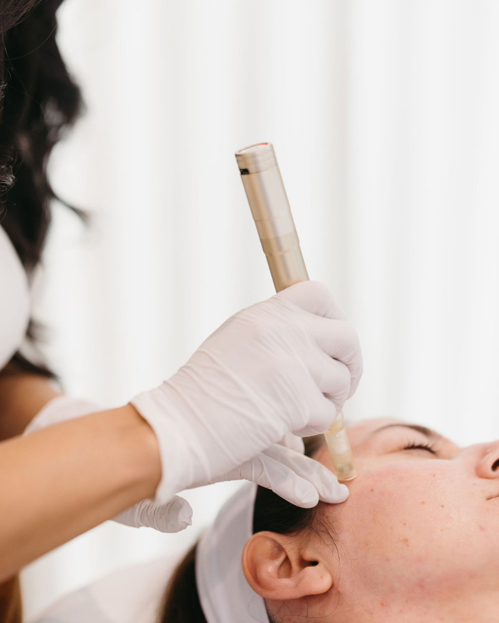 When Will I See Microneedling Results?