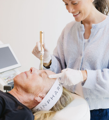 Microneedling vs. Laser Treatments: Which Is Right?