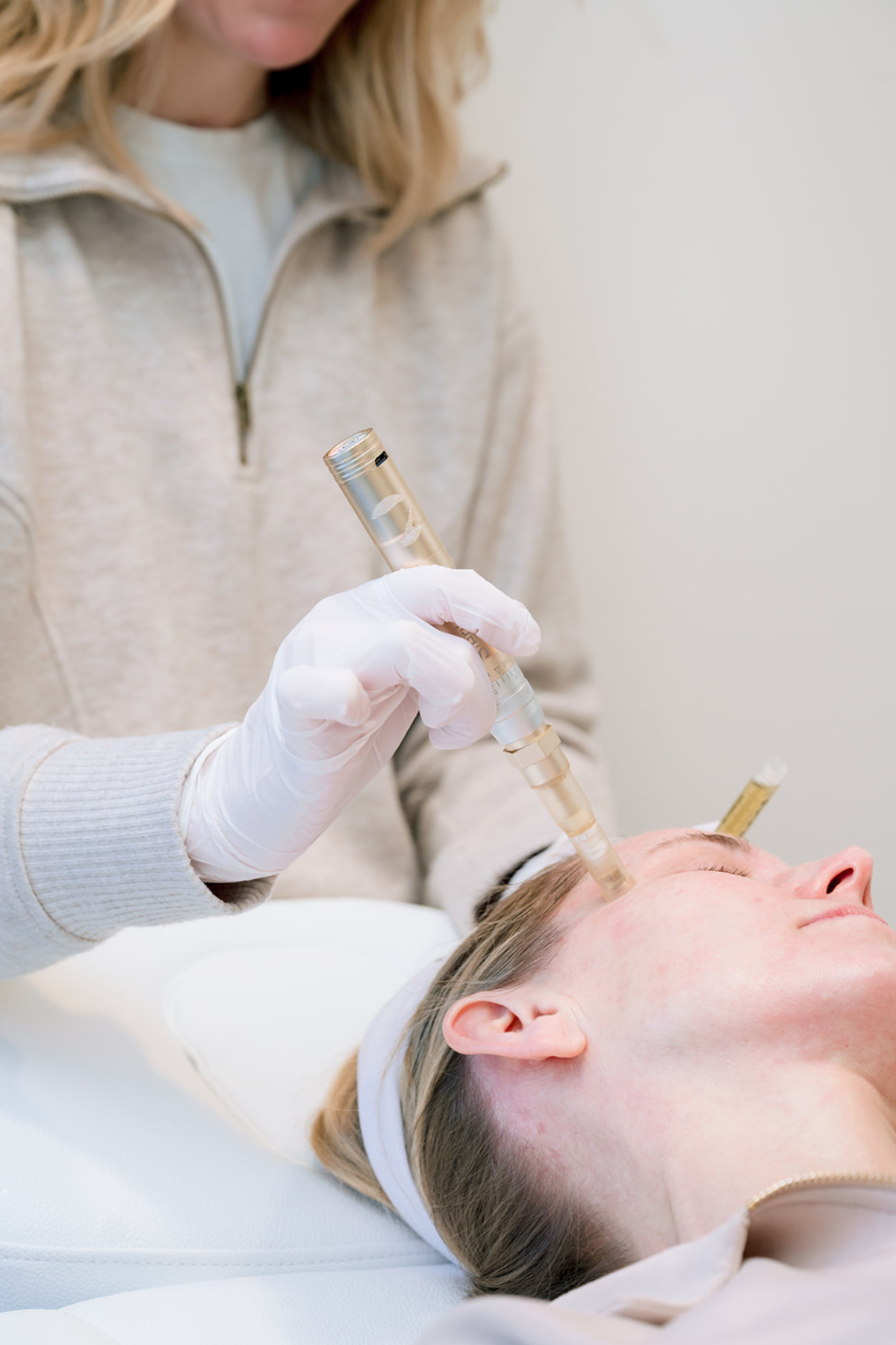 When Will I See Microneedling Results?