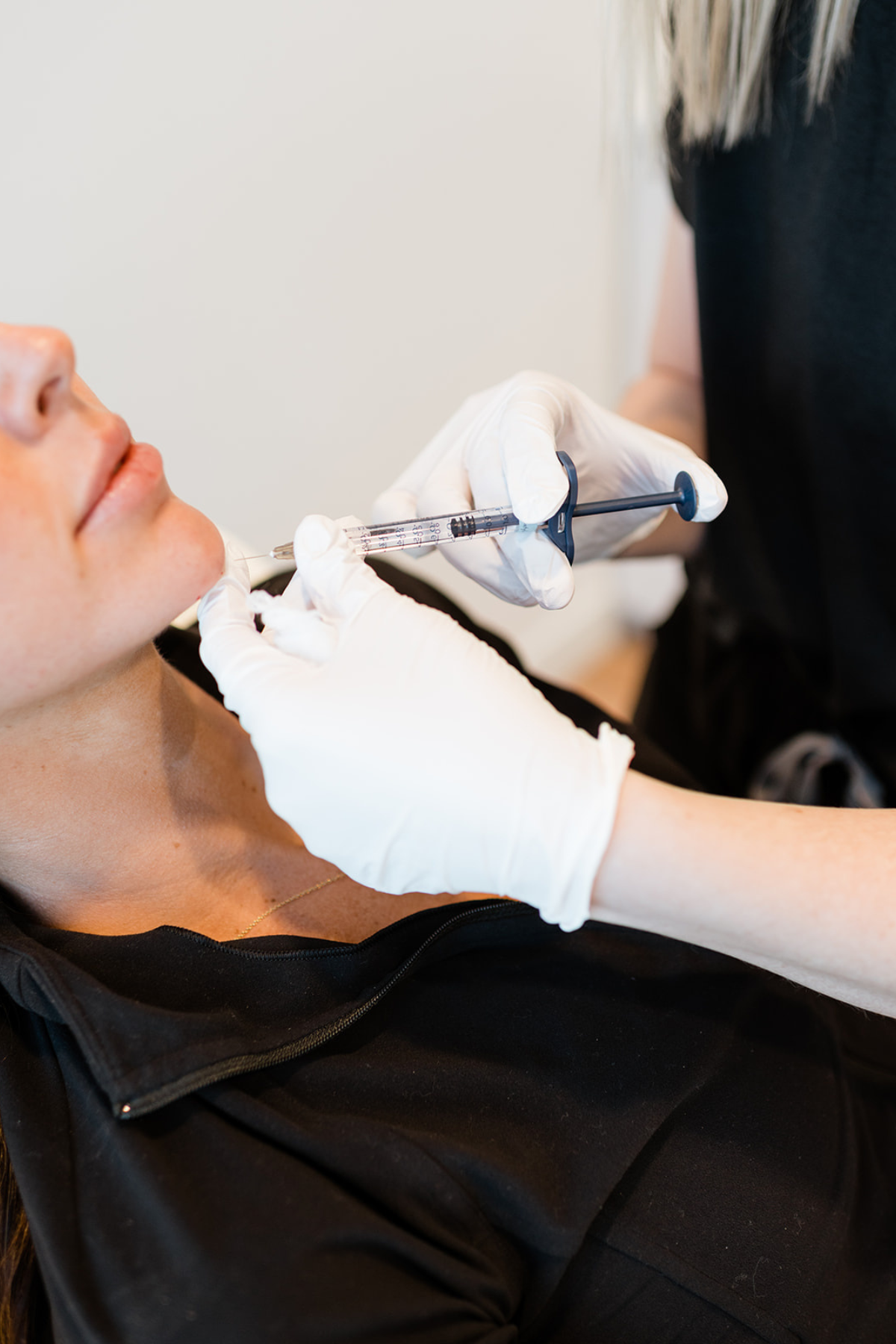 Fillers: Why We Love Them (And Why You Will, Too!)