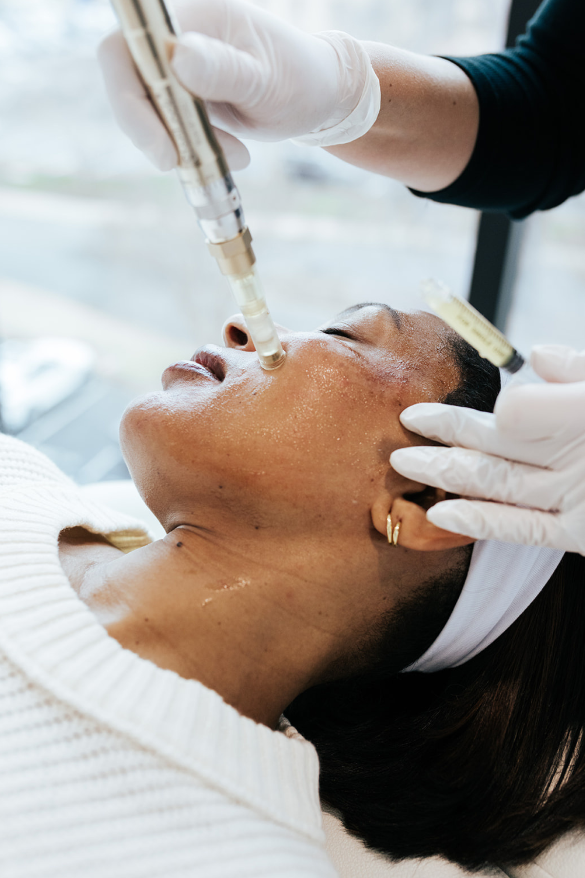 Types of Microneedling + Which Is Right for You
