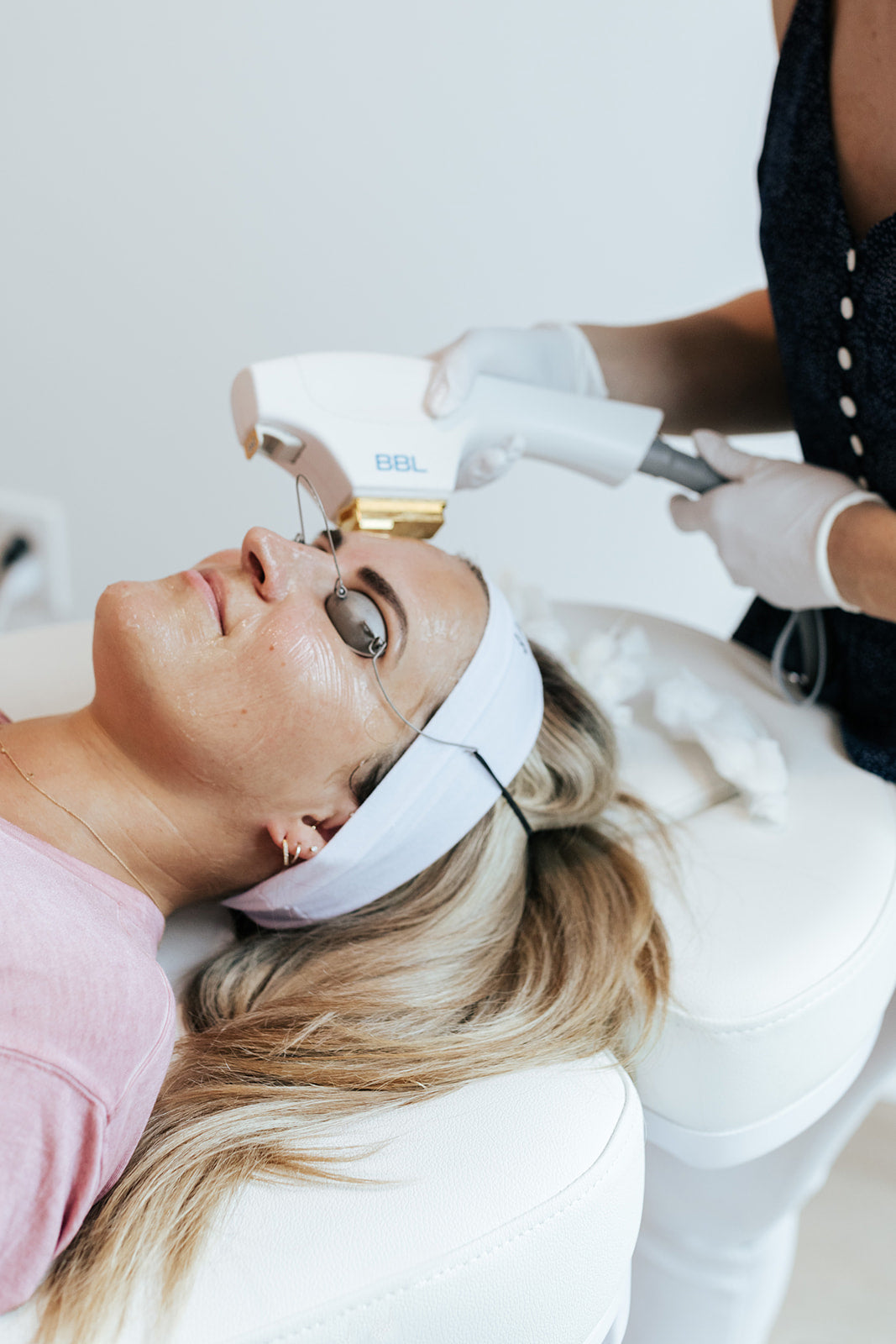BBL Photofacial: What It Is, How It Works and What To Expect