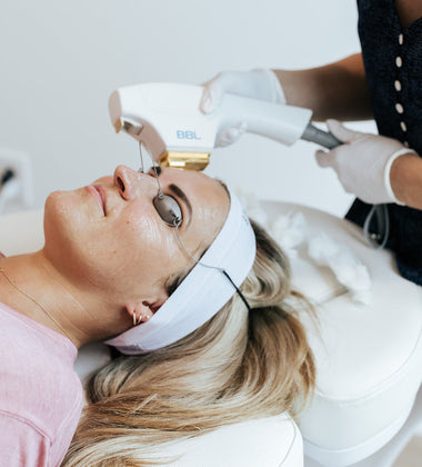 BBL Photofacial: What It Is, How It Works and What To Expect